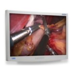 EndoVue 32"