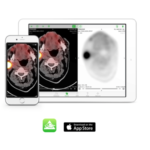 OsiriX HD a full medical images viewer for iOS (iPhone & iPad).