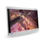 RADIANCE ULTRA 32”